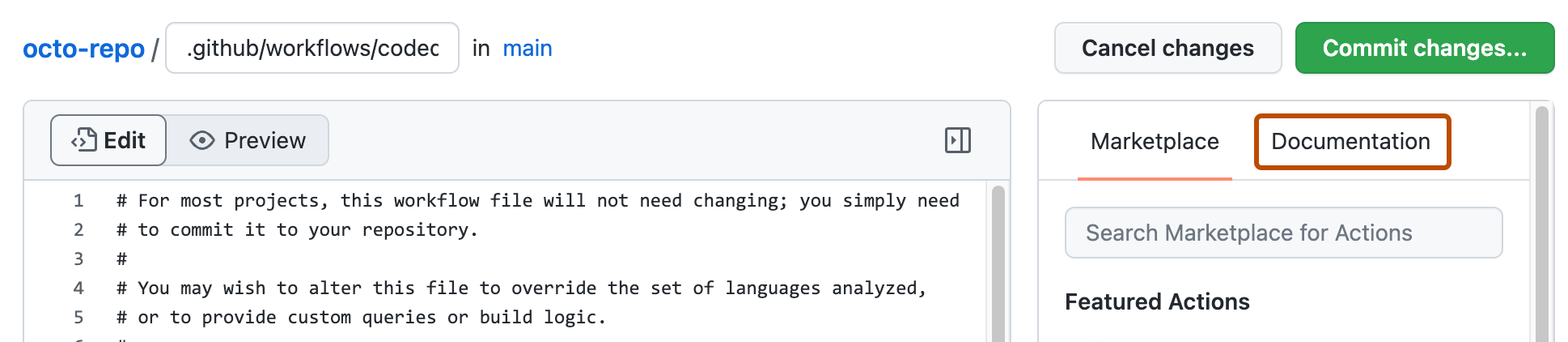 Capture d’écran montrant un fichier de workflow de démarrage ouvert pour modification. Le bouton « Documentation » est mis en évidence à l’aide d’un rectangle orange.